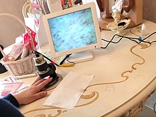 毛細血管血流チェック画像１