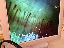 毛細血管血流チェック画像2