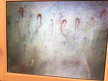 毛細血管血流チェック画像3